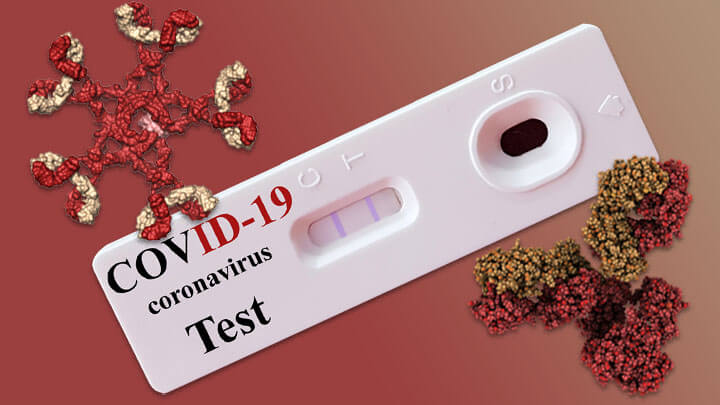 COVID-19 Type Virus